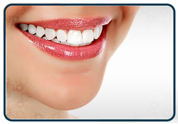 ابتسامة هوليود