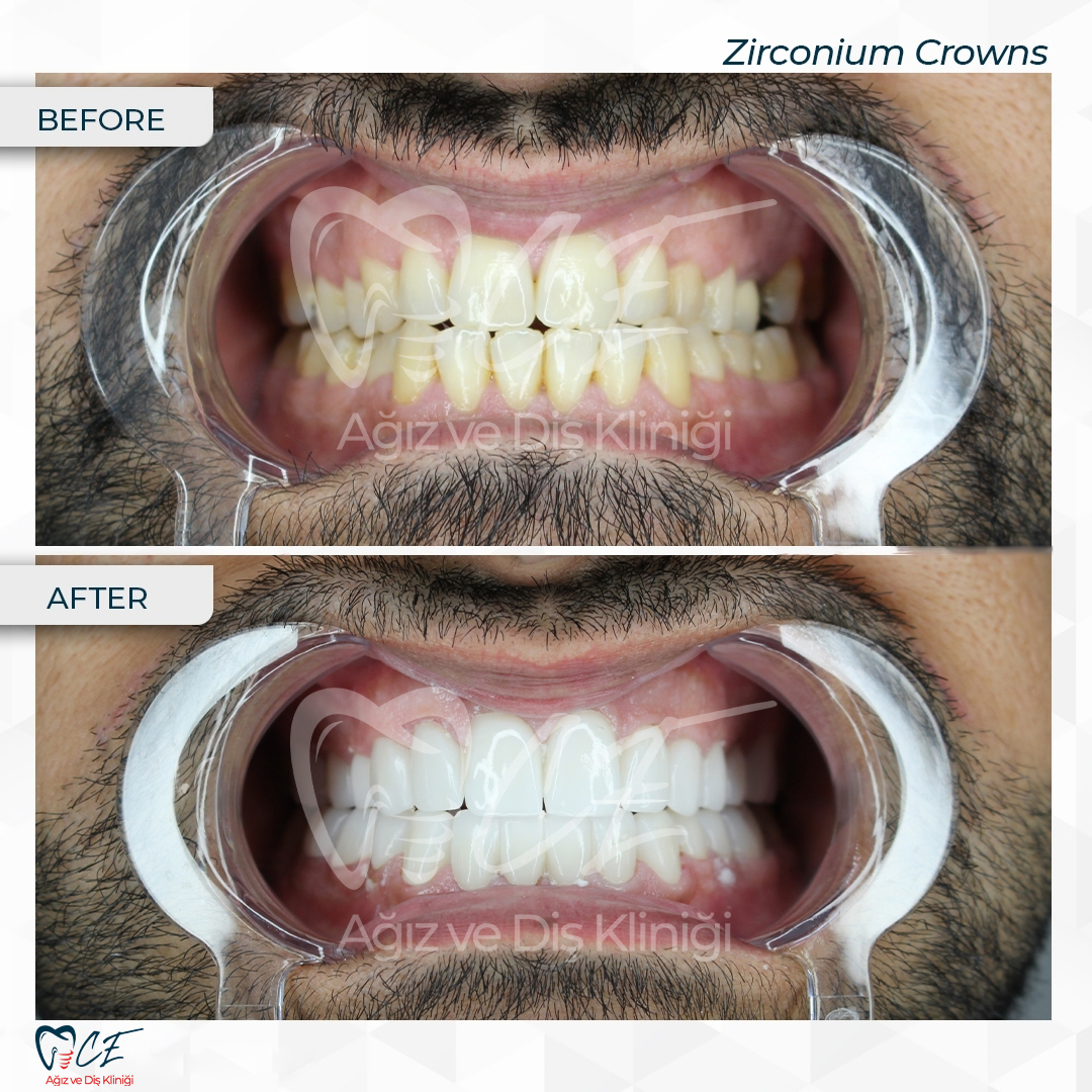 CE Ağız Diş Dental Aesthetic
