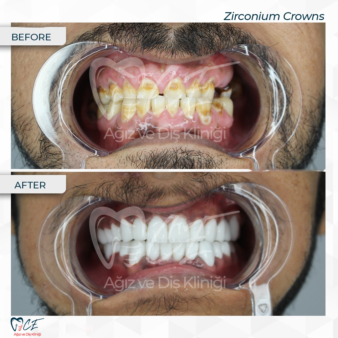 CE Ağız Diş Dental Aesthetic