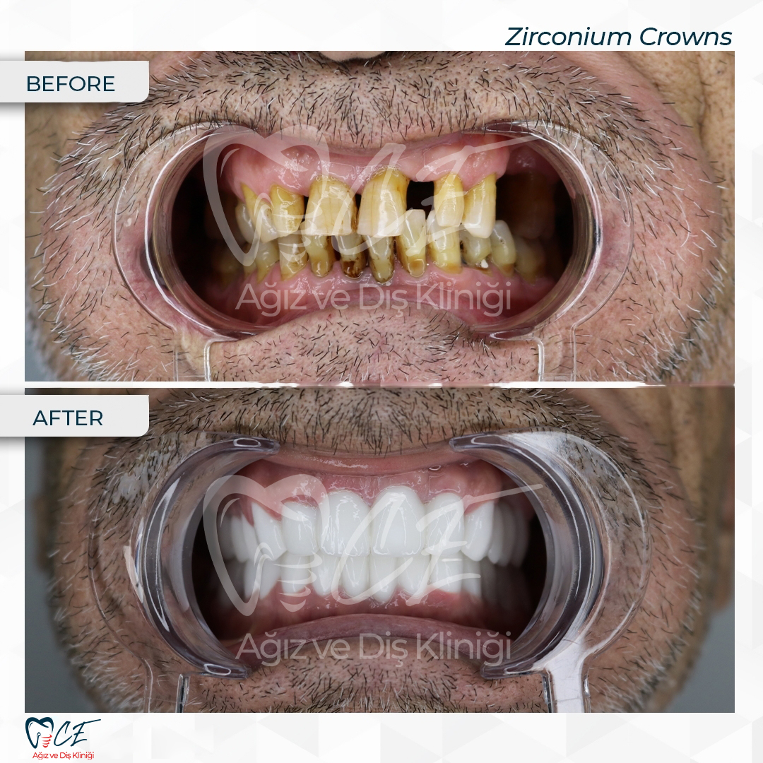 CE Ağız Diş Dental Aesthetic