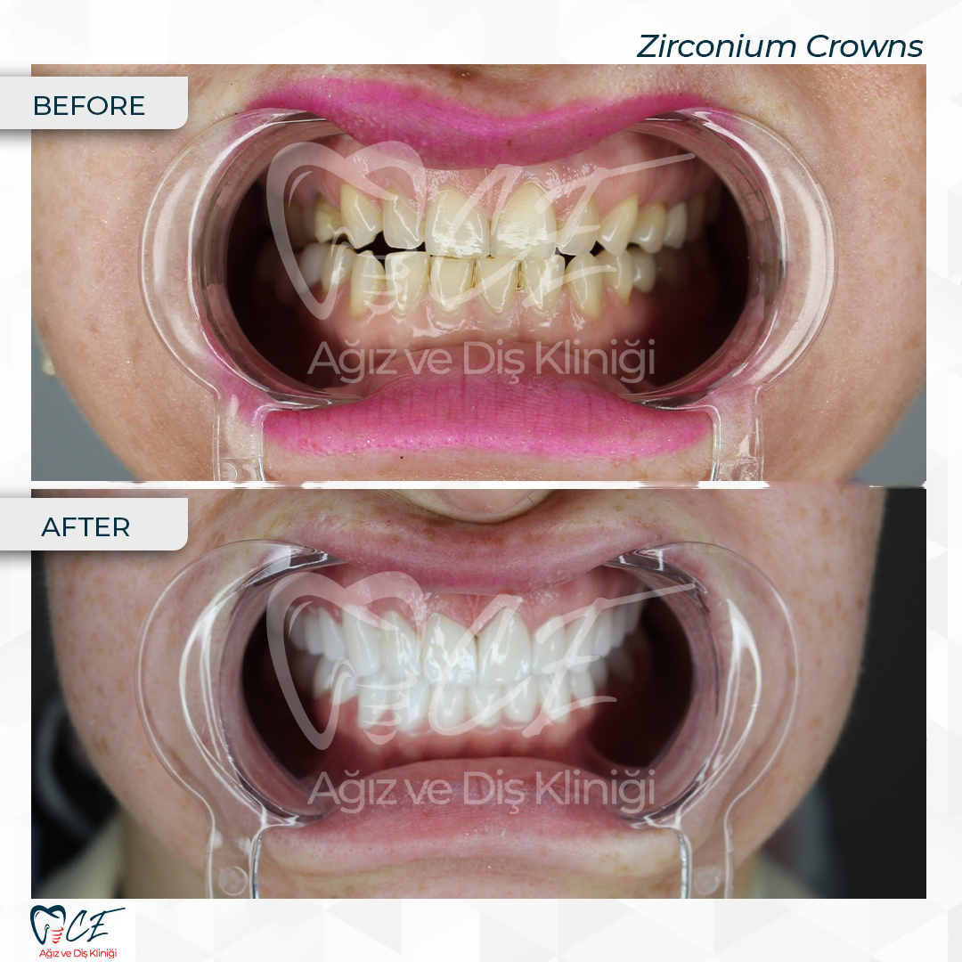 CE Ağız Diş Dental Aesthetic