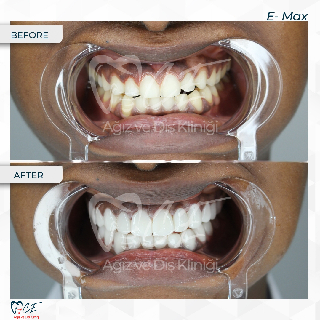 CE Ağız Diş Dental Aesthetic