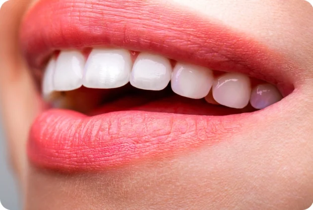 Hollywood Smile